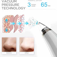 Vacuum Blackhead Remover Cleaner