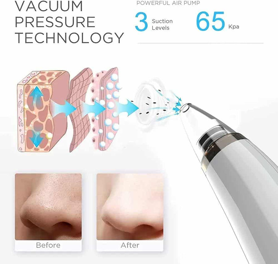 Vacuum Blackhead Remover Cleaner